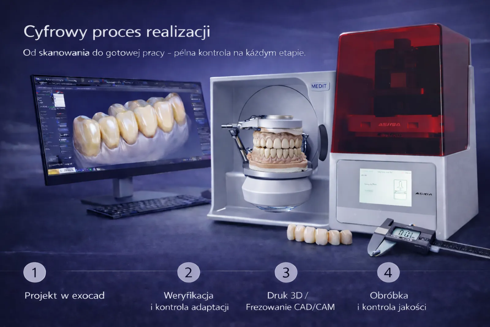 Mosty na filarach implantologicznych projektowane cyfrowo